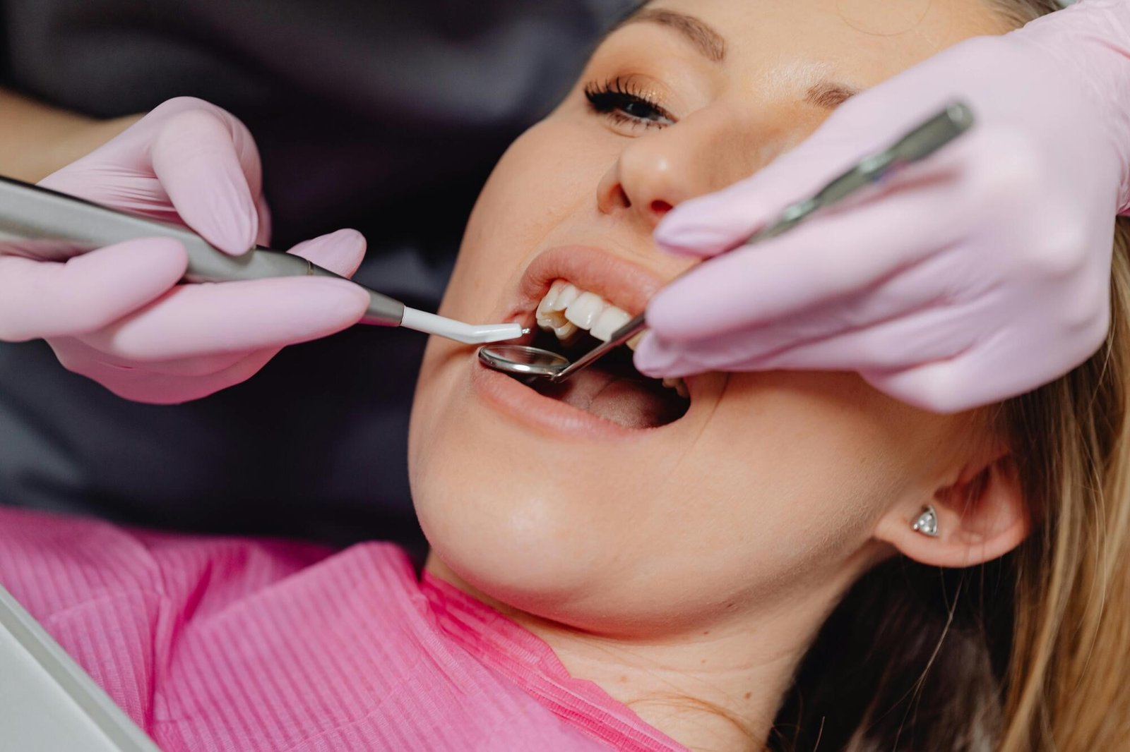 Dental Crowns