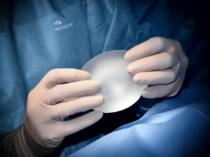 breast augmentation